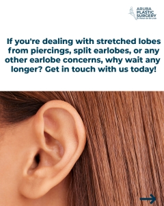 Ear Lobule Reconstruction-“Lobuloplasty